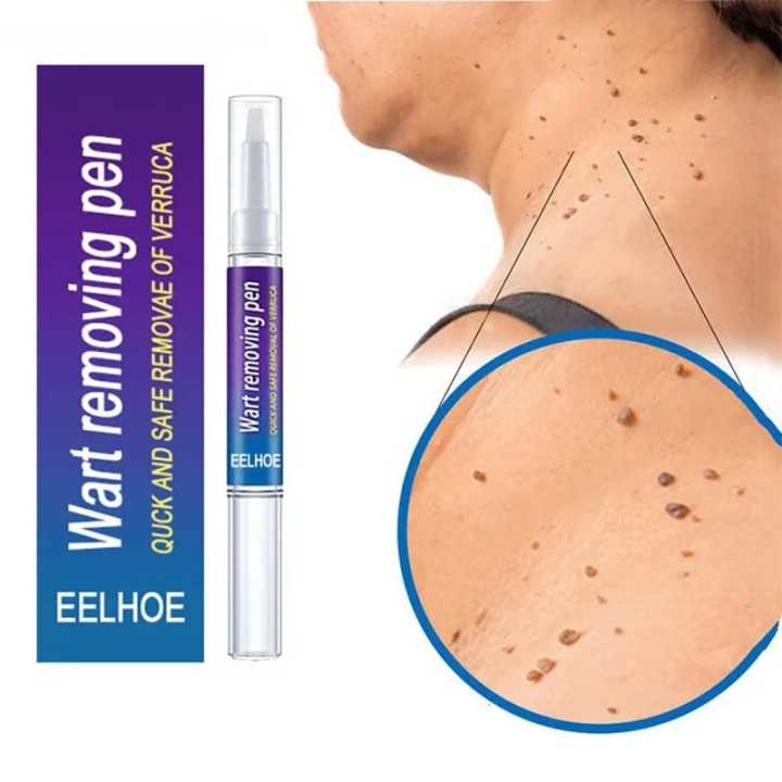 Wart Removal Pen